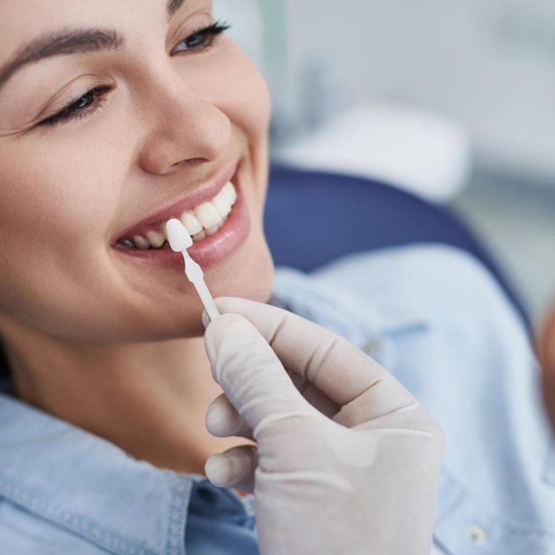 Clareamento Dental - Comparando tonalidade dos dentes